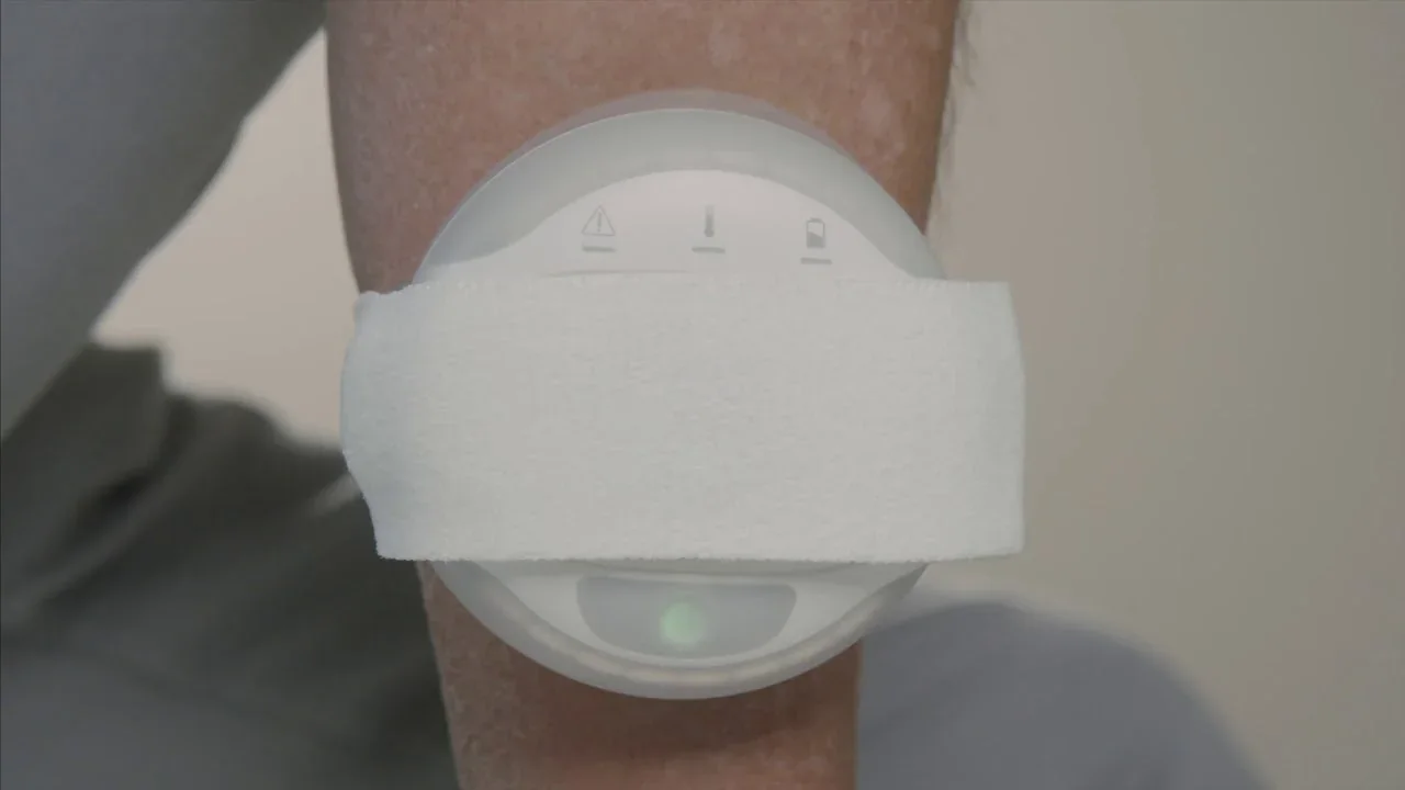 COMS® One applied to the lower leg with its fixation band