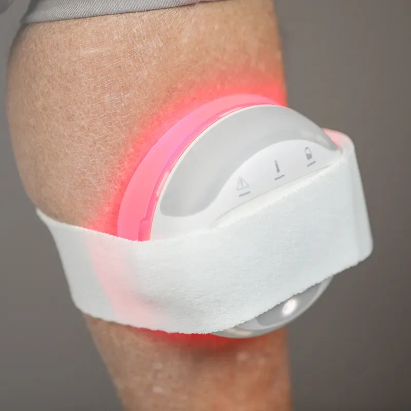 COMS® One applied with fixation band, emitting red light