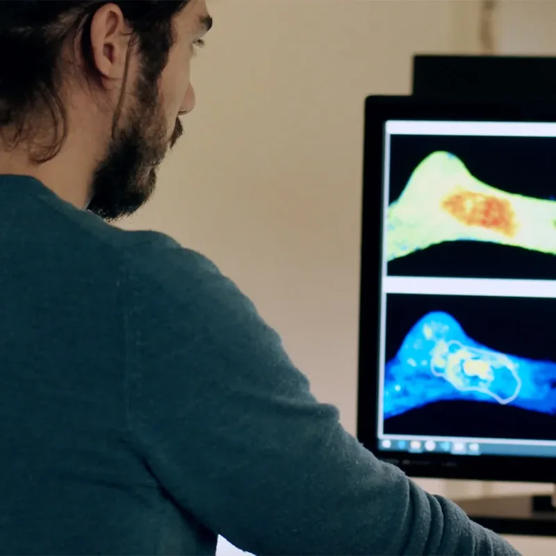 Clinician applying COMS® therapy to a patient's leg